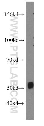 TRAIP Antibody in Western Blot (WB)
