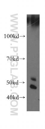 TRAIP Antibody in Western Blot (WB)