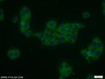 TRAIP Antibody in Immunocytochemistry (ICC/IF)