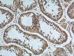 TRAIP Antibody in Immunohistochemistry (Paraffin) (IHC (P))