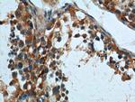 TRAIP Antibody in Immunohistochemistry (Paraffin) (IHC (P))