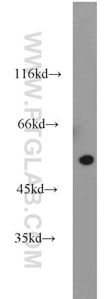TRAIP Antibody in Western Blot (WB)