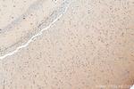 CHRNA3 Antibody in Immunohistochemistry (Paraffin) (IHC (P))