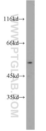 CHRNA3 Antibody in Western Blot (WB)
