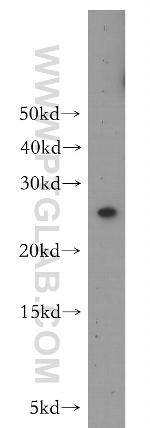 MAD2L1 Antibody in Western Blot (WB)