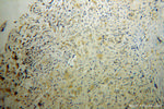 RAB6B Antibody in Immunohistochemistry (Paraffin) (IHC (P))