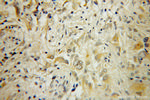 RAB6B Antibody in Immunohistochemistry (Paraffin) (IHC (P))
