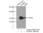 RAB6B Antibody in Immunoprecipitation (IP)