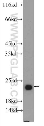 RAB6B Antibody in Western Blot (WB)