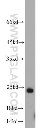 RAB6B Antibody in Western Blot (WB)