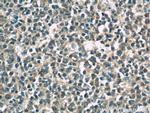 CD320 Antibody in Immunohistochemistry (Paraffin) (IHC (P))