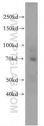 CD320 Antibody in Western Blot (WB)
