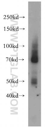 CD320 Antibody in Western Blot (WB)