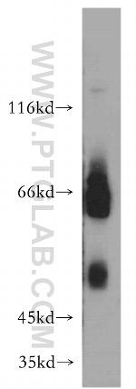 CD320 Antibody in Western Blot (WB)