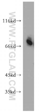 CD320 Antibody in Western Blot (WB)
