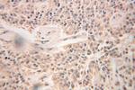 RNH1 Antibody in Immunohistochemistry (Paraffin) (IHC (P))