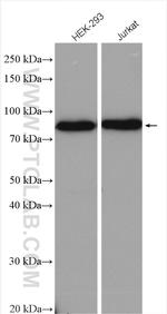 NCBP1 Antibody in Western Blot (WB)