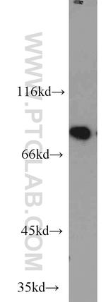 NCBP1 Antibody in Western Blot (WB)