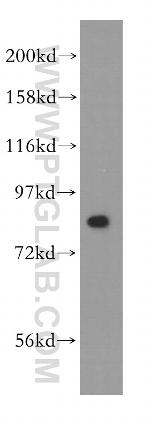 NCBP1 Antibody in Western Blot (WB)