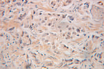 GRWD1 Antibody in Immunohistochemistry (Paraffin) (IHC (P))