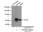 GRWD1 Antibody in Immunoprecipitation (IP)