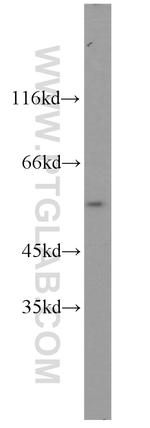 GRWD1 Antibody in Western Blot (WB)