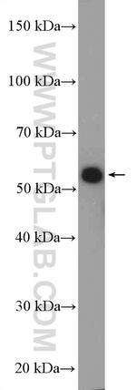 GRWD1 Antibody in Western Blot (WB)