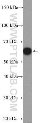 GRWD1 Antibody in Western Blot (WB)