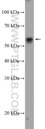 GRWD1 Antibody in Western Blot (WB)