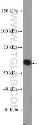 GRWD1 Antibody in Western Blot (WB)