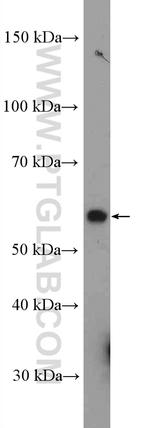 GRWD1 Antibody in Western Blot (WB)