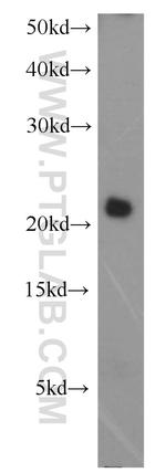 P21 Antibody in Western Blot (WB)