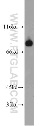 HBS1L Antibody in Western Blot (WB)