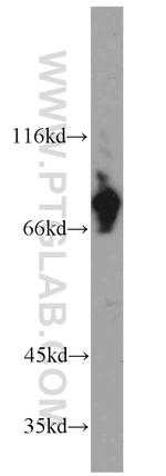 HBS1L Antibody in Western Blot (WB)