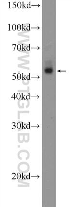 ZNF256 Antibody in Western Blot (WB)