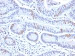 BRAF35/HMG20B Monoclonal Antibody (PCRP-HMG20B-1B5)