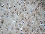 DKK3 Antibody in Immunohistochemistry (Paraffin) (IHC (P))