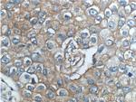 ERBB3 Antibody in Immunohistochemistry (Paraffin) (IHC (P))