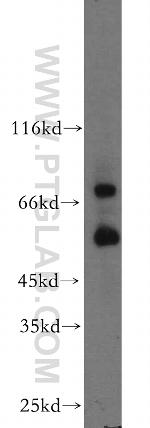 MMP2 Antibody in Western Blot (WB)