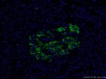 MMP7 Antibody in Immunohistochemistry (PFA fixed) (IHC (PFA))