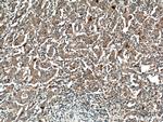 MMP7 Antibody in Immunohistochemistry (Paraffin) (IHC (P))