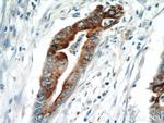 MMP7 Antibody in Immunohistochemistry (Paraffin) (IHC (P))