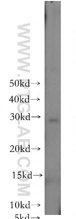 MMP7 Antibody in Western Blot (WB)