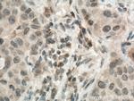 MMP9 (N-terminal) Antibody in Immunohistochemistry (Paraffin) (IHC (P))