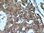 SNRPD3 Antibody in Immunohistochemistry (Paraffin) (IHC (P))