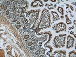 SNRPD3 Antibody in Immunohistochemistry (Paraffin) (IHC (P))