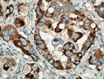 TTK Antibody in Immunohistochemistry (Paraffin) (IHC (P))
