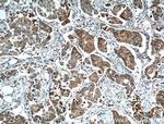 TTK Antibody in Immunohistochemistry (Paraffin) (IHC (P))