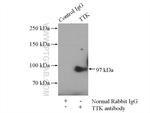 TTK Antibody in Immunoprecipitation (IP)