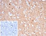 Tubulin beta 3/TUBB3 (Neuronal and Stem Cell Marker) Monoclonal Antibody (rTUBB3/7405)